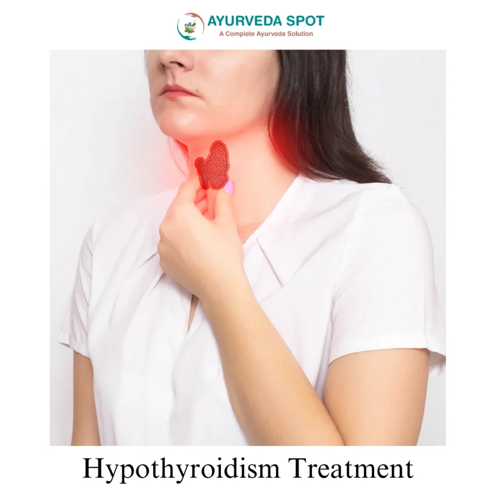 hypothyroidism treatment