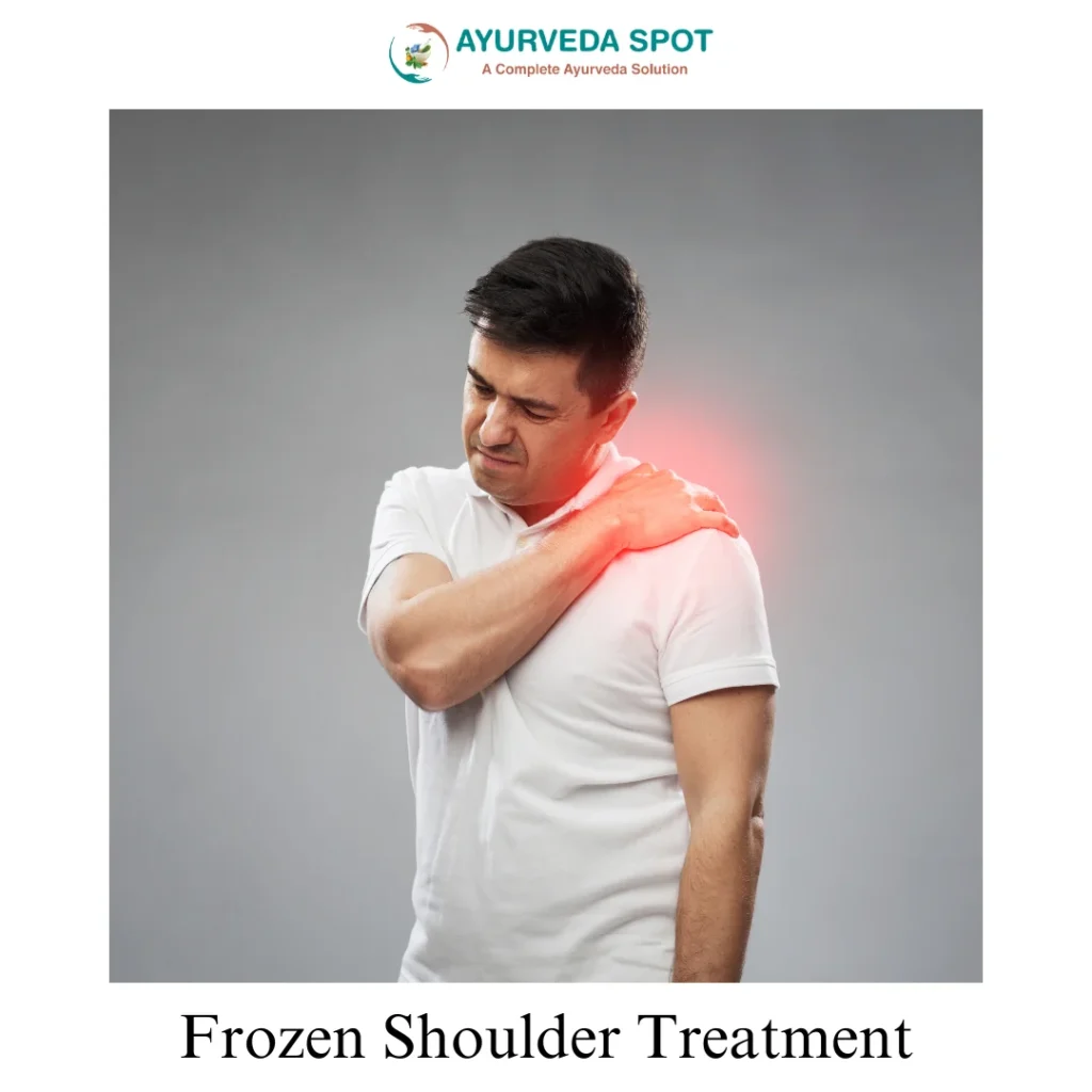 frozen shoulder Treatment