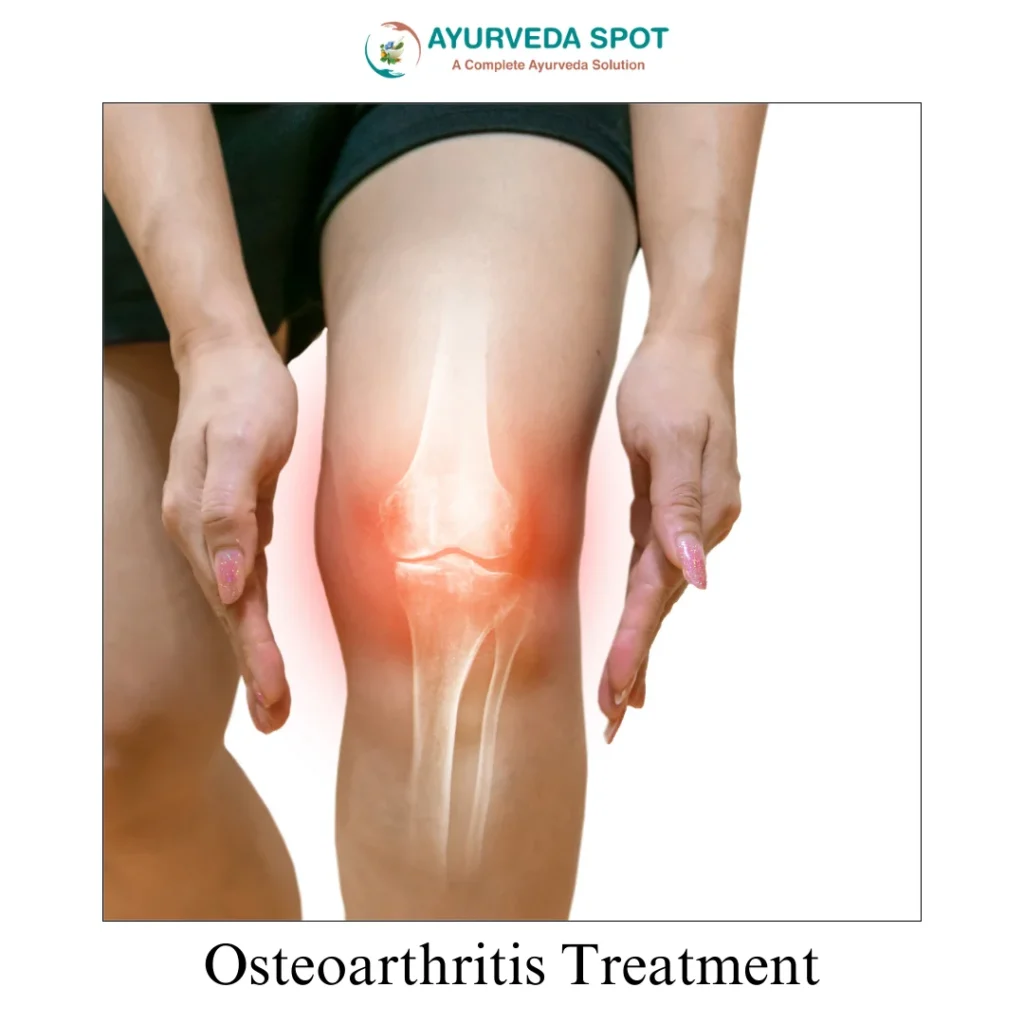 osteoathritis Treatment