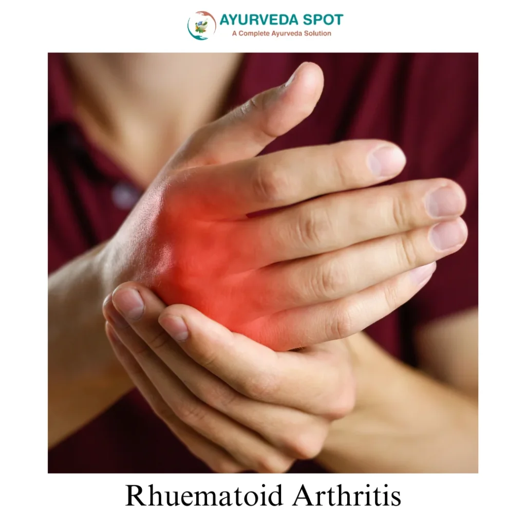 Rhuematoid Arthritis